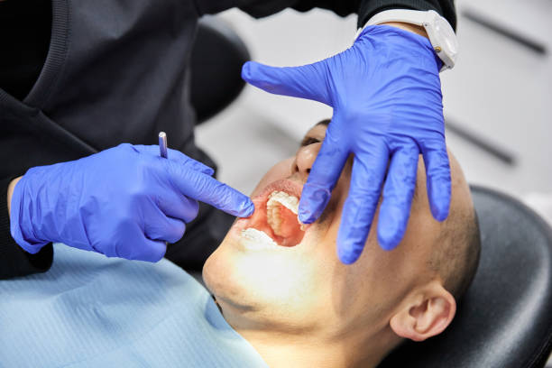 Best Emergency Wisdom Teeth Removal in Westwood, PA